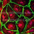 Human Primary Pancreatic Microvascular Endothelial Cells